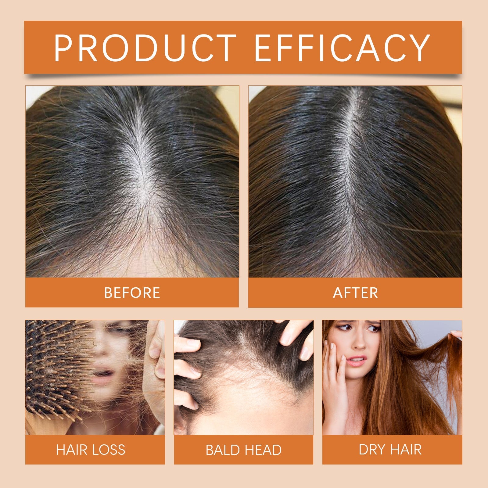 Hair Regrowth Ampoules, Nourish The Scalp To Promote Germinal Nourish Hair Follicle Health Care Essence eprolo
