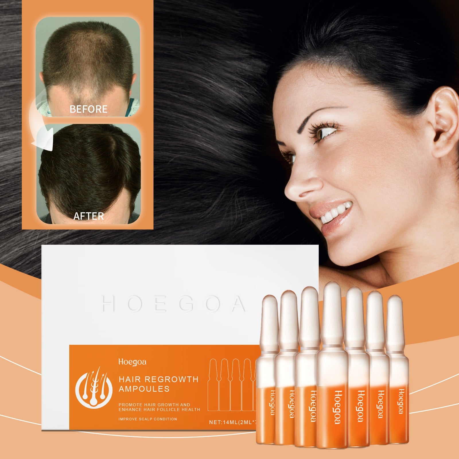 Hair Regrowth Ampoules, Nourish The Scalp To Promote Germinal Nourish Hair Follicle Health Care Essence eprolo