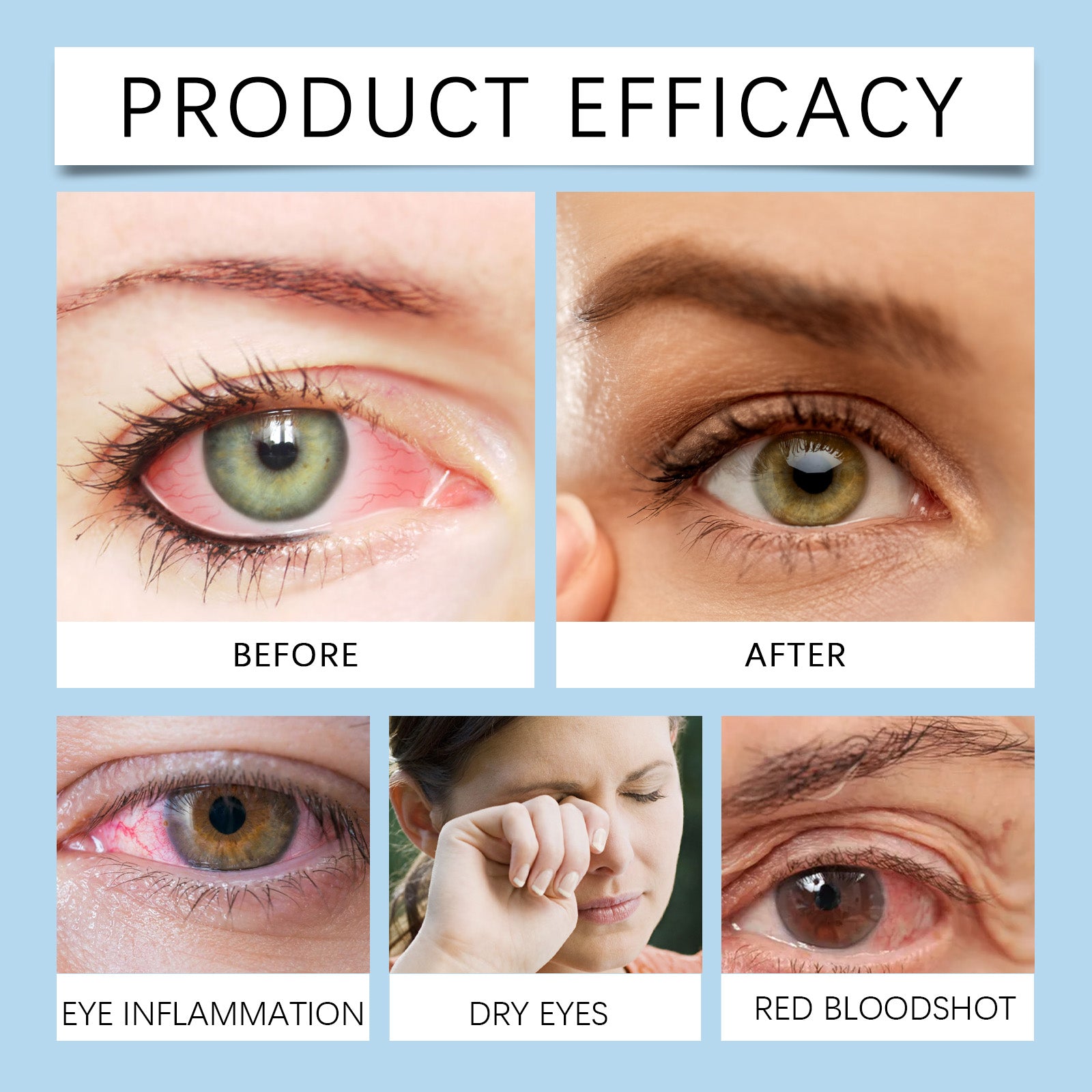 Eye Drops, Eye Moisturizing Drops Relieve Dryness Soothing Moisturizing Maintenance Eye Health Care Solution eprolo